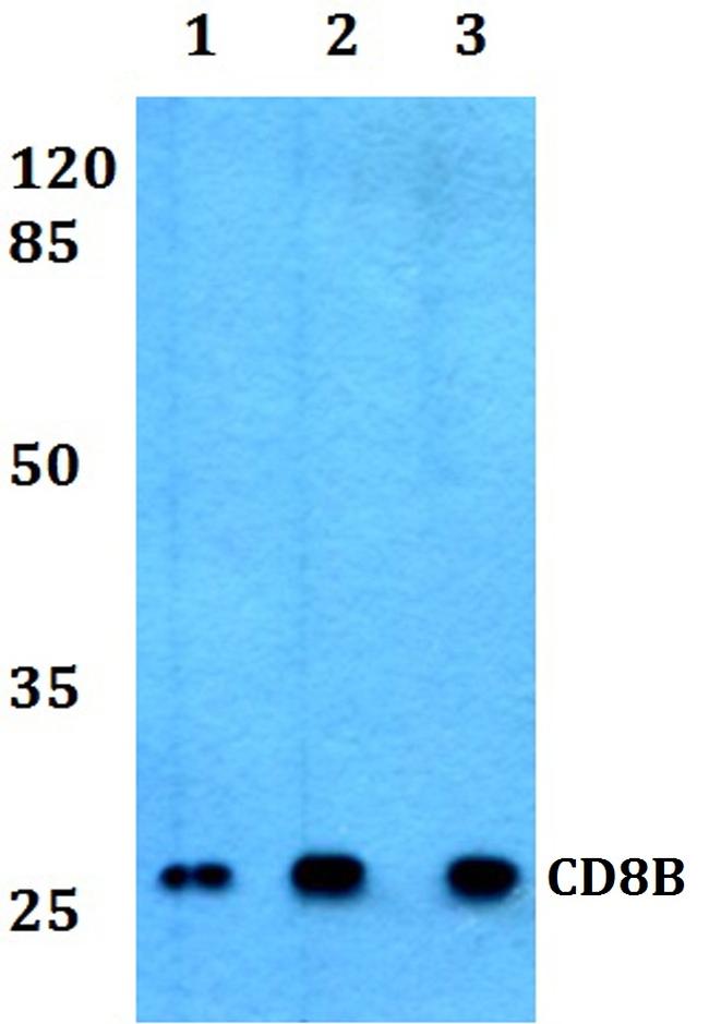 CD8 beta Antibody in Western Blot (WB)