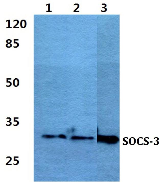 SOCS3 Antibody in Western Blot (WB)