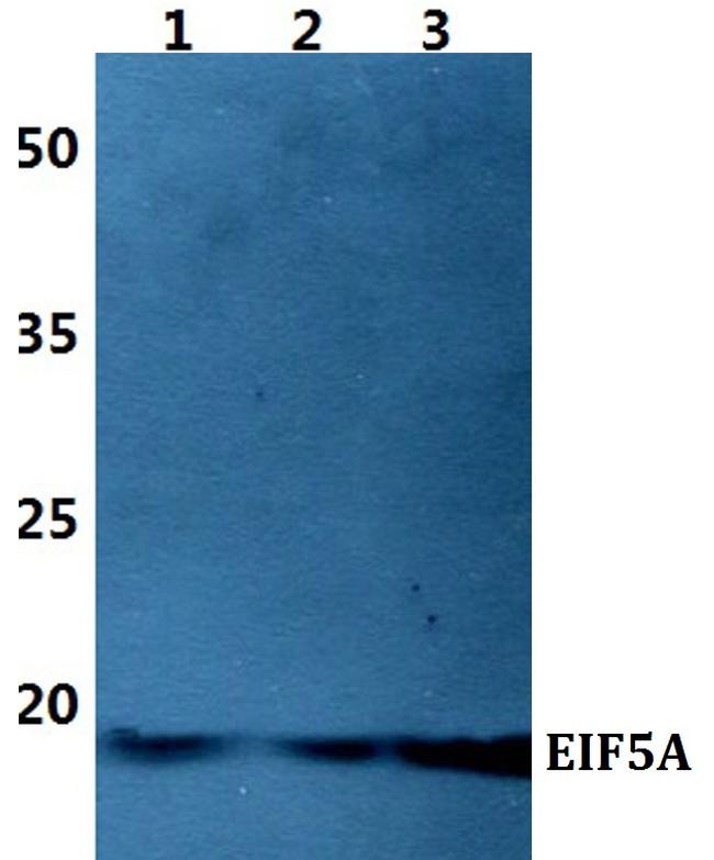 eIF5A Antibody in Western Blot (WB)