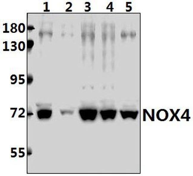 NOX4 Antibody in Western Blot (WB)