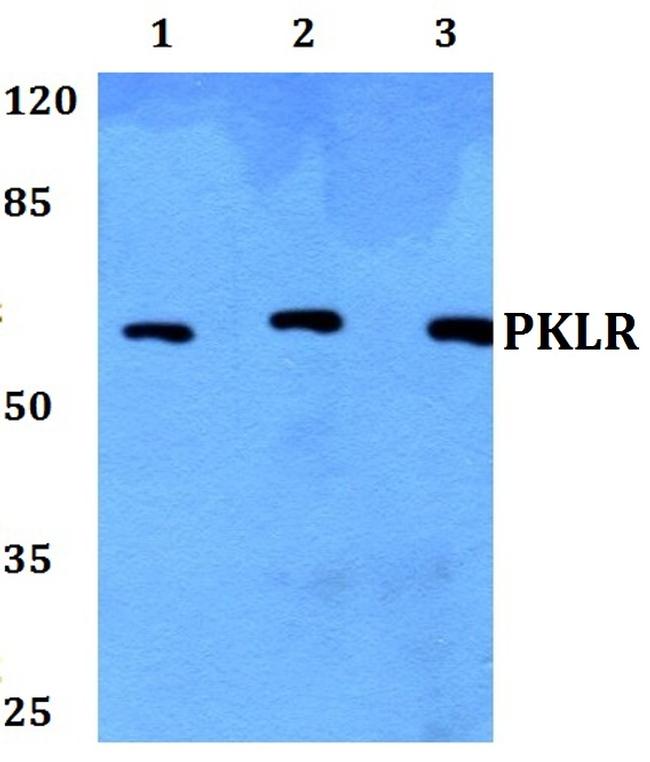 PKLR Antibody in Western Blot (WB)