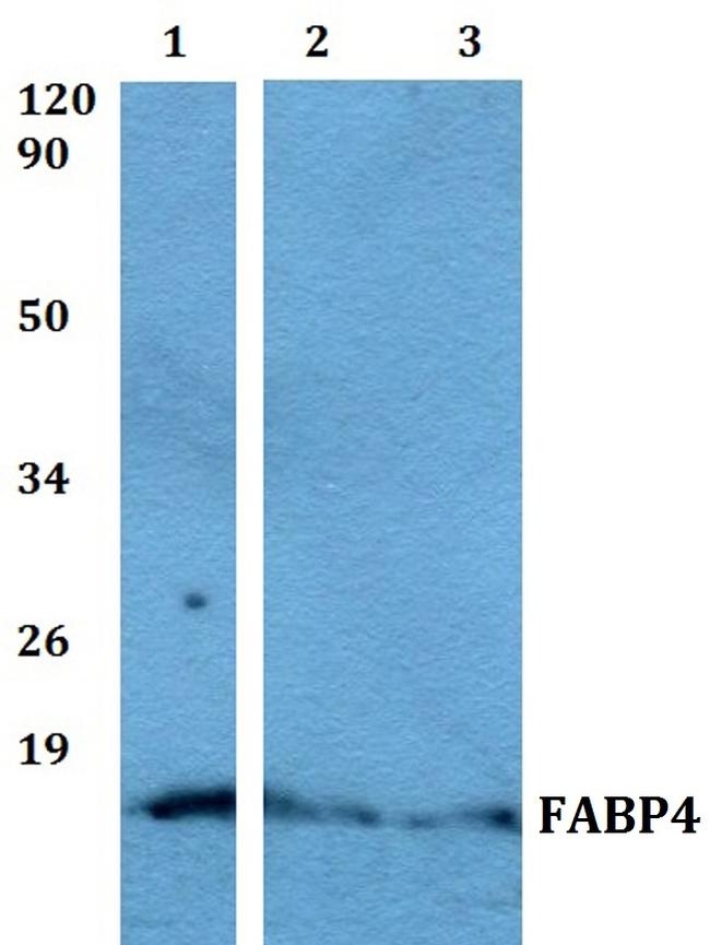 FABP4 Antibody in Western Blot (WB)
