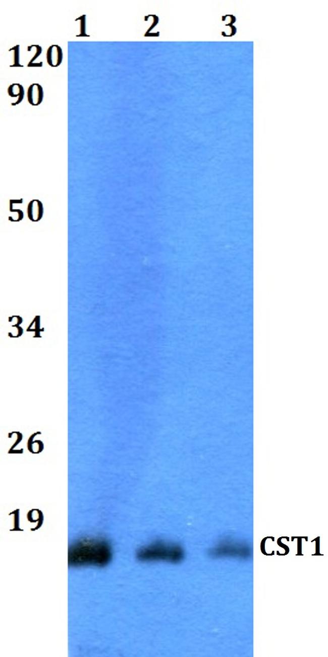 CST1 Antibody in Western Blot (WB)