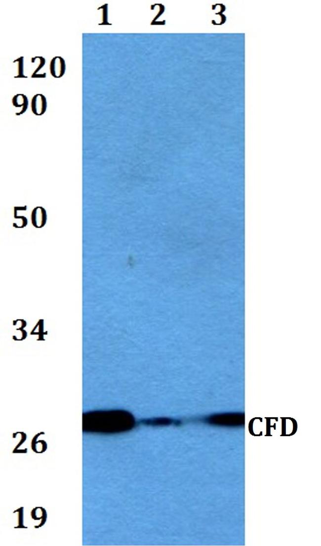 Complement Factor D Antibody in Western Blot (WB)