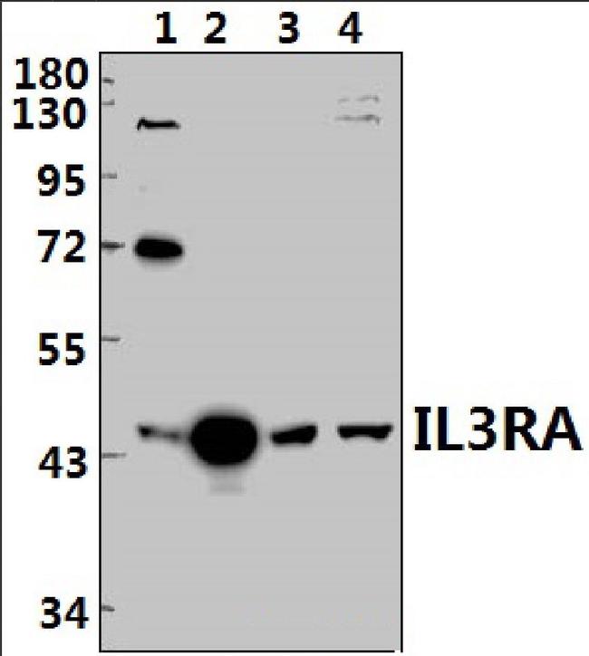 CD123 Antibody in Western Blot (WB)