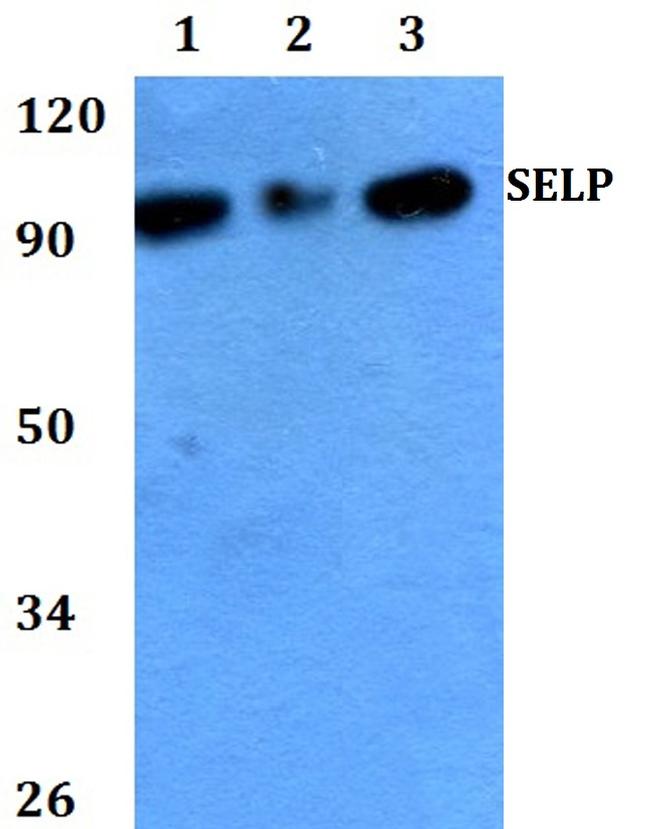 P-Selectin Antibody in Western Blot (WB)