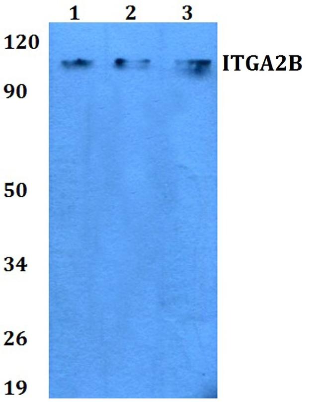 CD41 Antibody in Western Blot (WB)