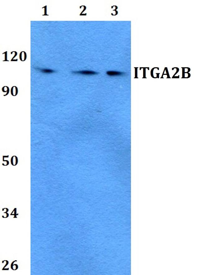 CD41 Antibody in Western Blot (WB)