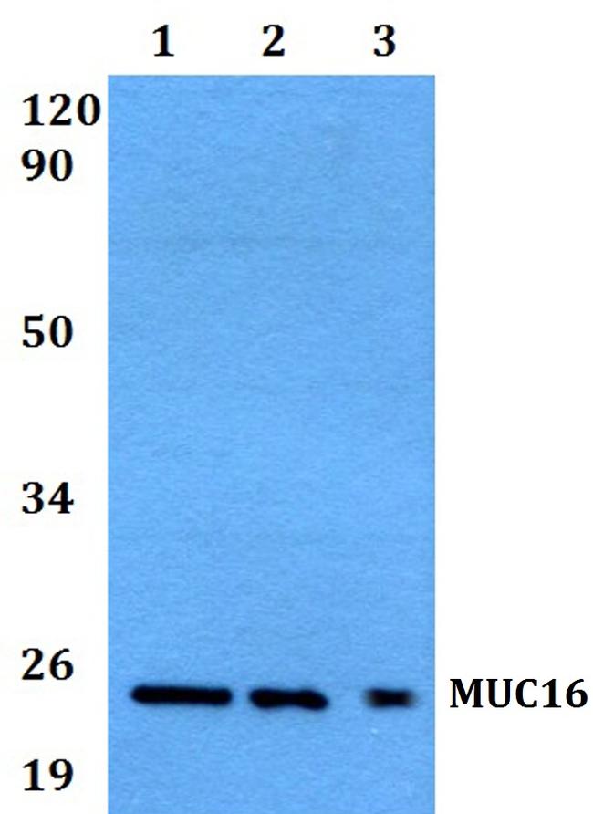 CA125 Antibody in Western Blot (WB)