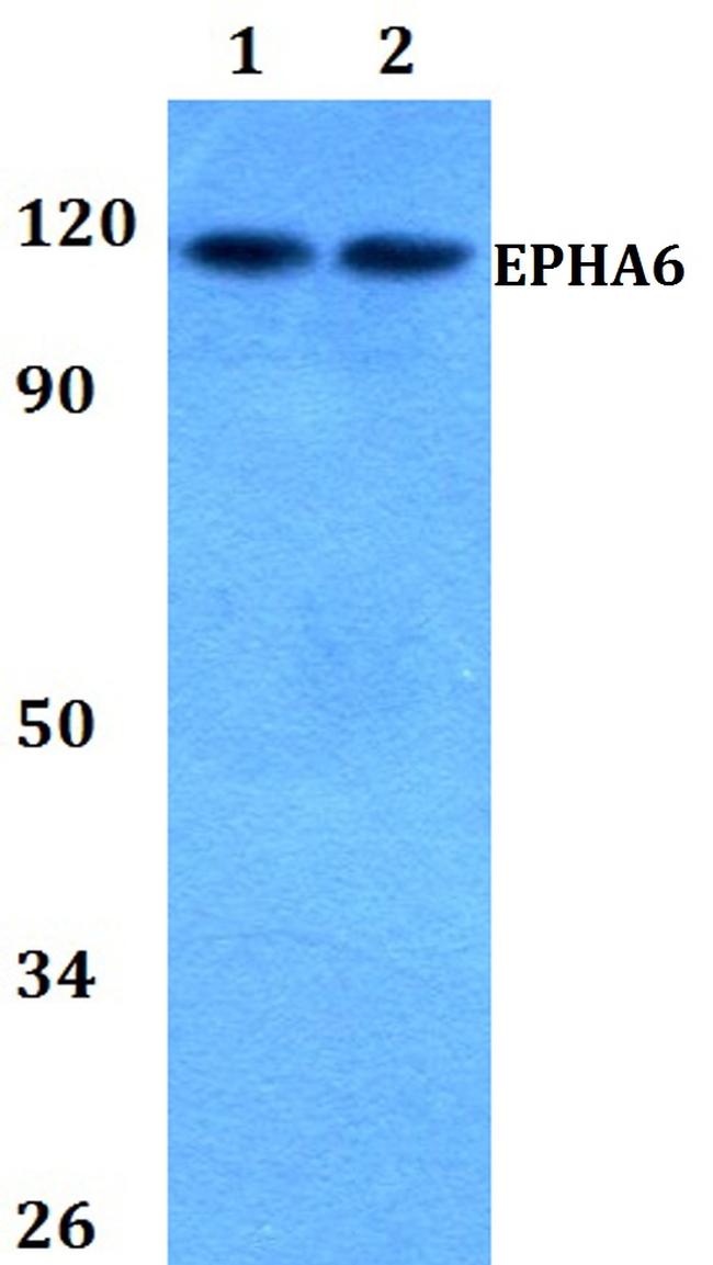 EphA6 Antibody in Western Blot (WB)