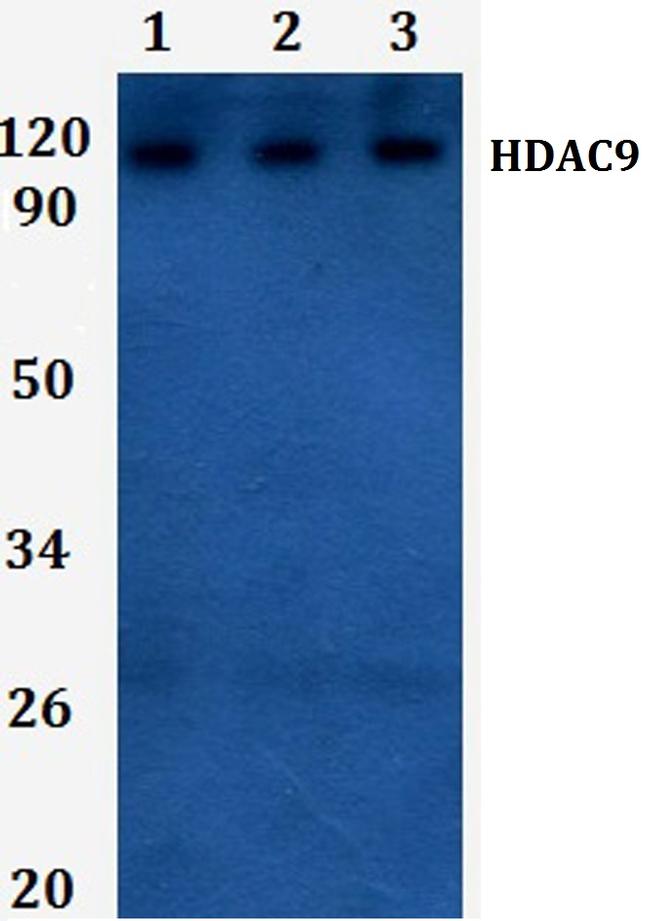 HDAC9 Antibody in Western Blot (WB)
