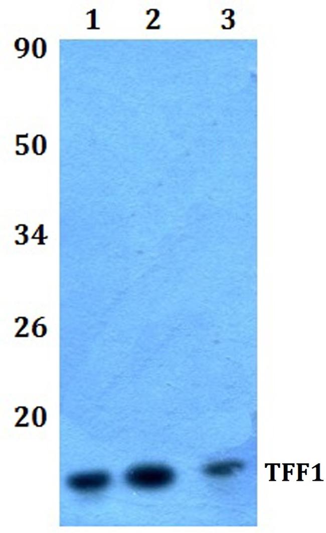 TFF1 Antibody in Western Blot (WB)