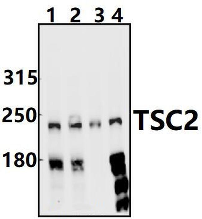 TSC2 Antibody in Western Blot (WB)