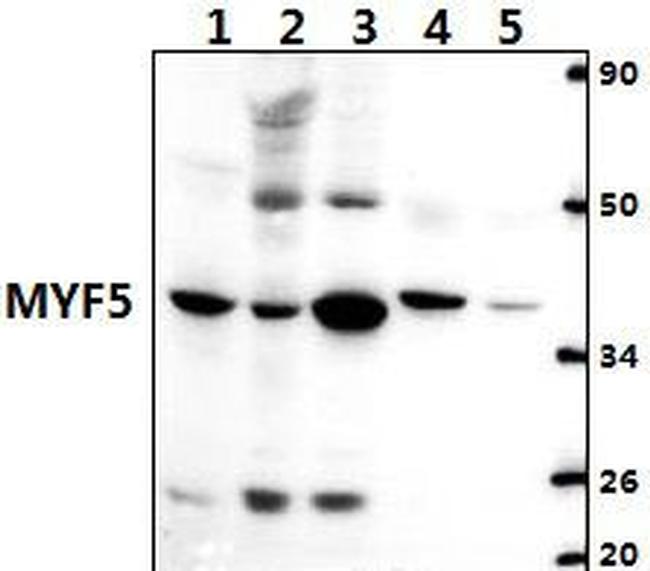MYF5 Antibody in Western Blot (WB)