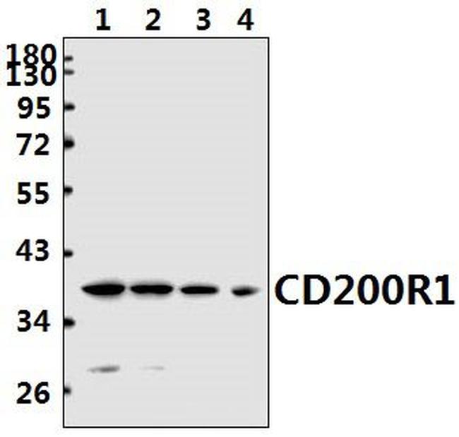 CD200R Antibody in Western Blot (WB)