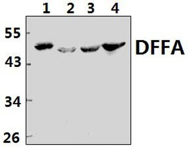 ICAD Antibody in Western Blot (WB)