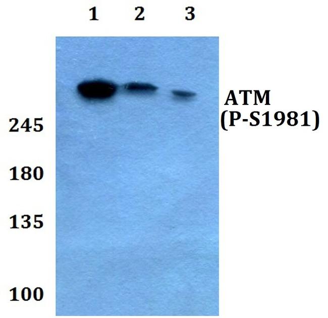 Phospho-ATM (Ser1981) Antibody in Western Blot (WB)