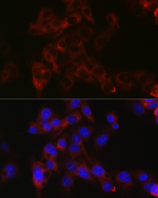 Apolipoprotein B Antibody in Immunocytochemistry (ICC/IF)