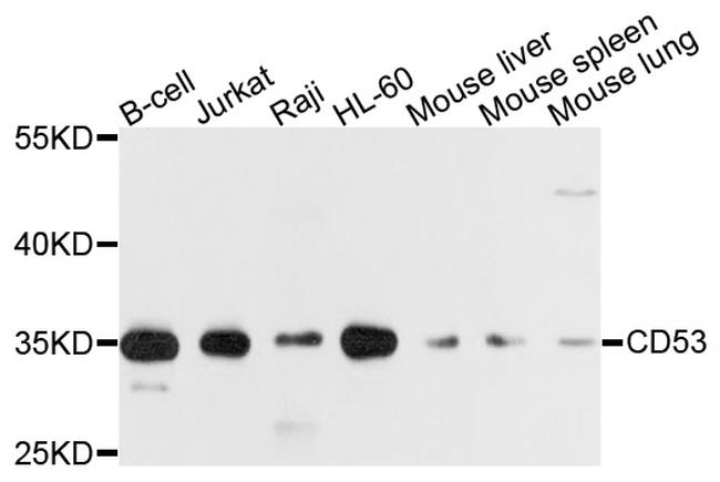 CD53 Antibody in Western Blot (WB)