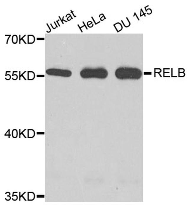 RelB Antibody in Western Blot (WB)