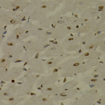 NFkB p52/p100 Antibody in Immunohistochemistry (Paraffin) (IHC (P))