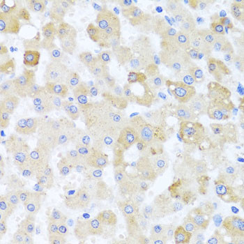 Centrin 1 Antibody in Immunohistochemistry (Paraffin) (IHC (P))