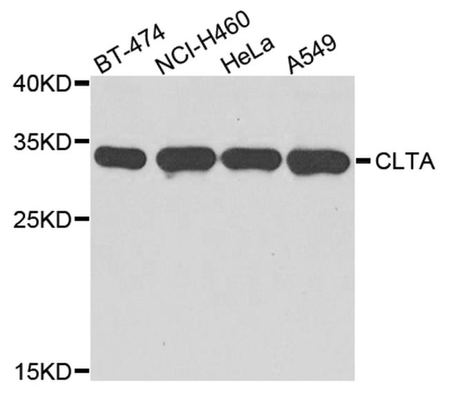 Clathrin Light Chain Antibody in Western Blot (WB)