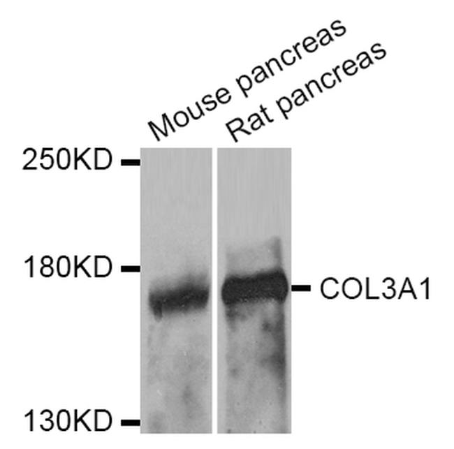 Collagen III Antibody in Western Blot (WB)