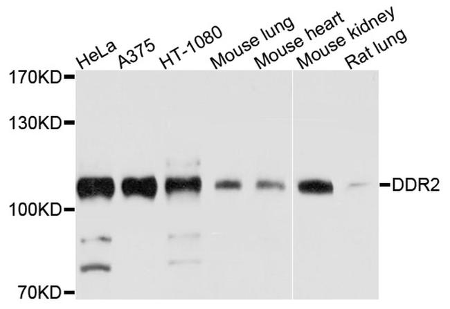 DDR2 Antibody in Western Blot (WB)