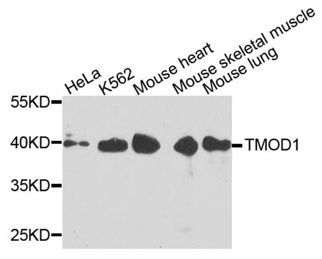 TMOD1 Antibody in Western Blot (WB)
