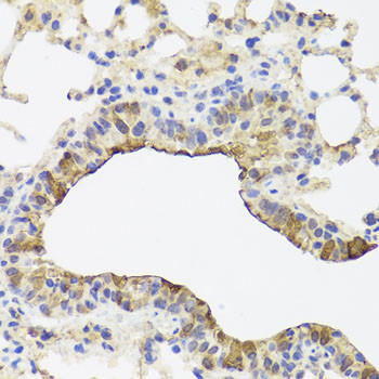 TOMM34 Antibody in Immunohistochemistry (Paraffin) (IHC (P))