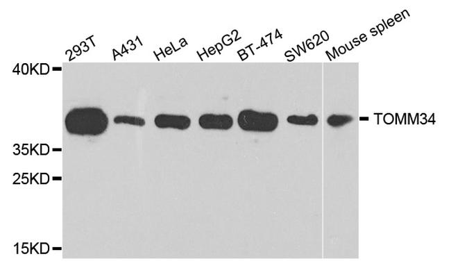TOMM34 Antibody in Western Blot (WB)