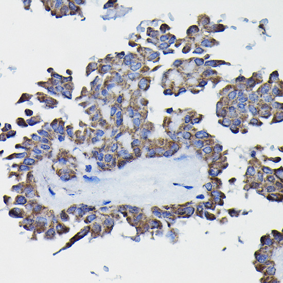 GSTK1 Antibody in Immunohistochemistry (Paraffin) (IHC (P))