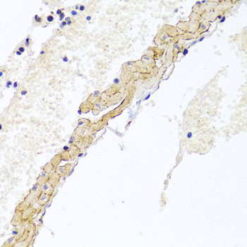 CD81 Antibody in Immunohistochemistry (Paraffin) (IHC (P))