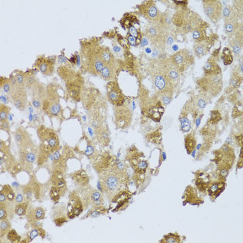 BNIP3 Antibody in Immunohistochemistry (Paraffin) (IHC (P))