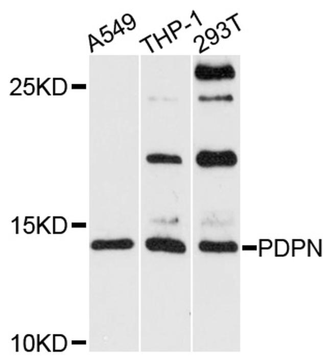 Podoplanin Antibody in Western Blot (WB)