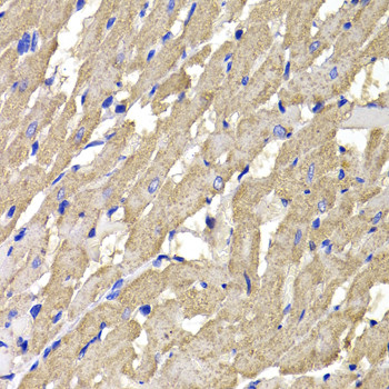 MPI Antibody in Immunohistochemistry (Paraffin) (IHC (P))