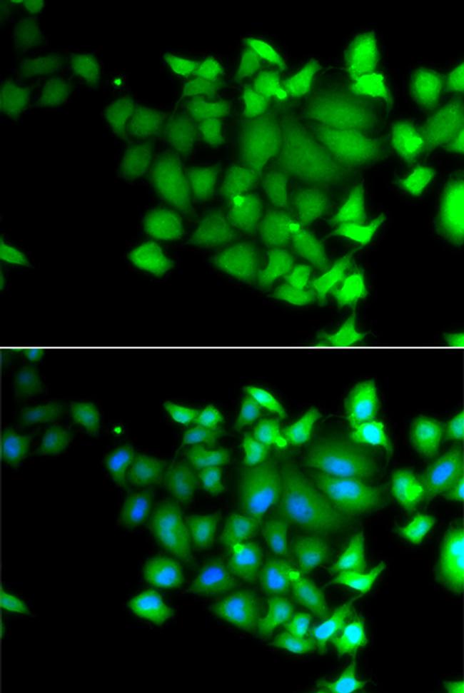 TET3 Antibody in Western Blot (WB)