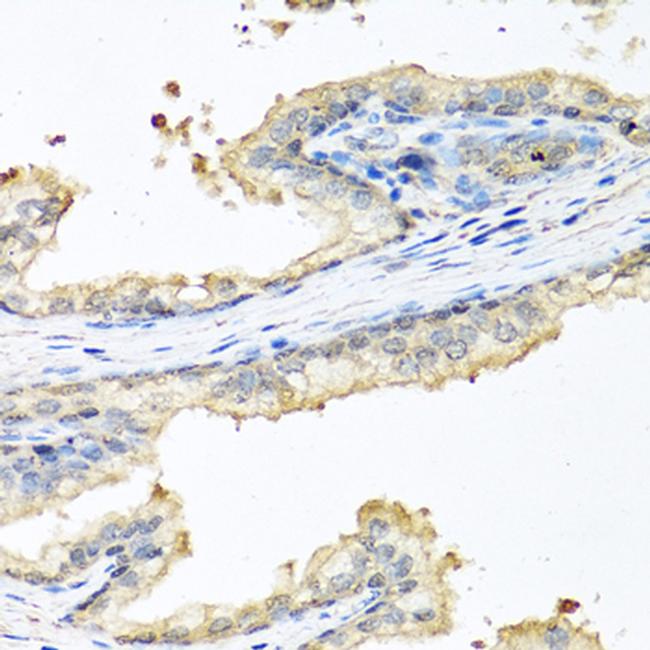 Ceruloplasmin Antibody in Western Blot (WB)