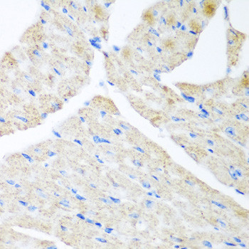 GABARAPL2 Antibody in Immunohistochemistry (Paraffin) (IHC (P))
