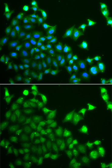 CBLC Antibody in Immunocytochemistry (ICC/IF)