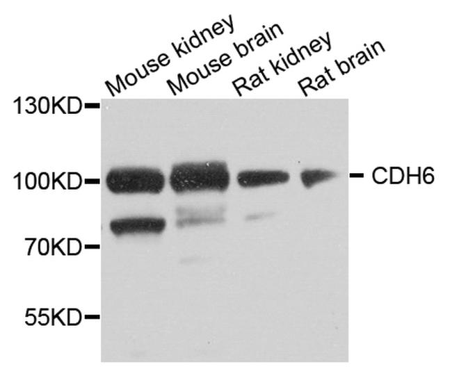 K-cadherin Antibody in Western Blot (WB)