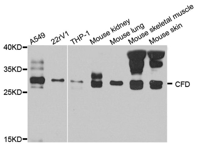 Complement Factor D Antibody in Western Blot (WB)