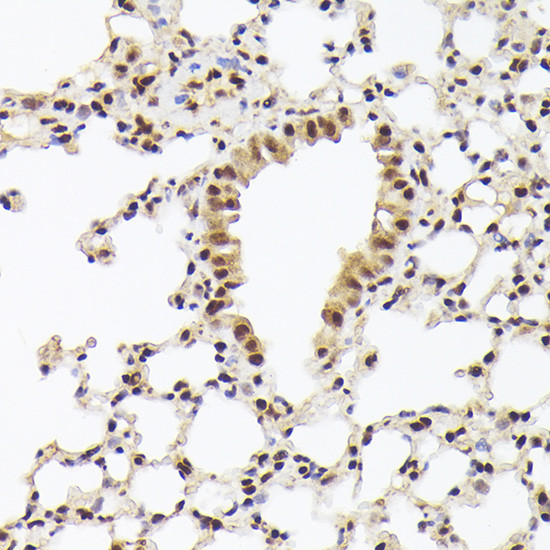 Nuclear Matrix Protein p84 Antibody in Immunohistochemistry (Paraffin) (IHC (P))