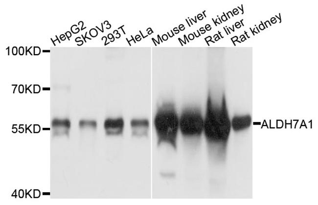 ALDH7A1 Antibody in Western Blot (WB)