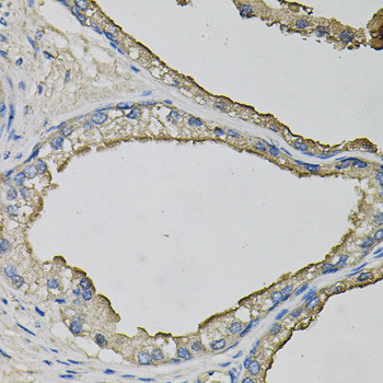 LCN1 Antibody in Immunohistochemistry (Paraffin) (IHC (P))