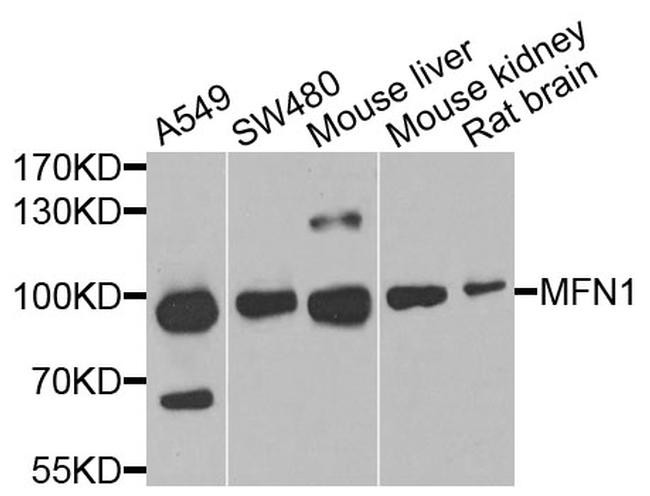 MFN1 Antibody in Western Blot (WB)
