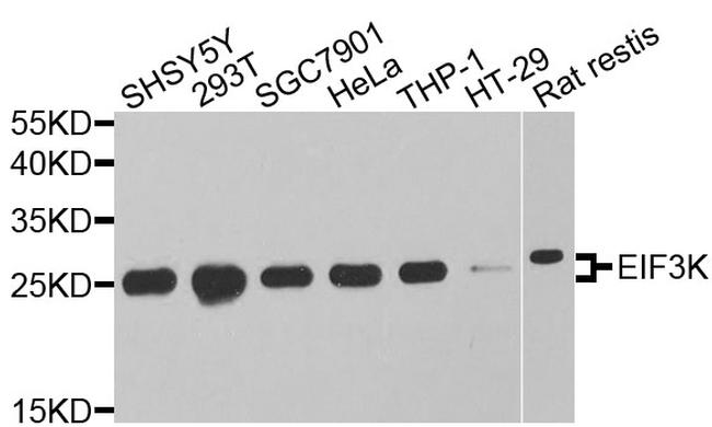 eIF3k Antibody in Western Blot (WB)