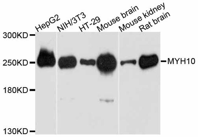 MYH10 Antibody in Western Blot (WB)