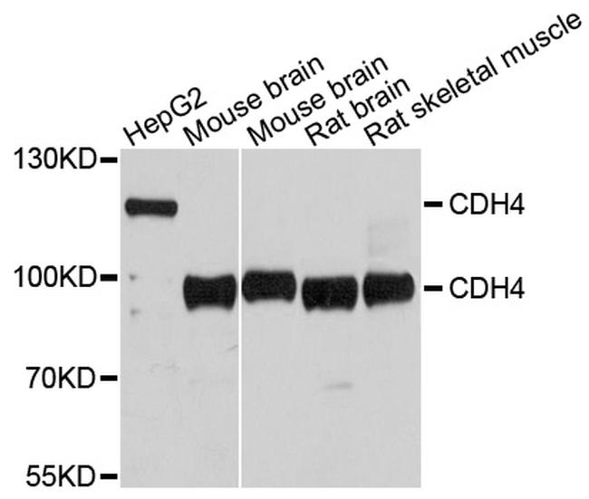 CDH4 Antibody in Western Blot (WB)